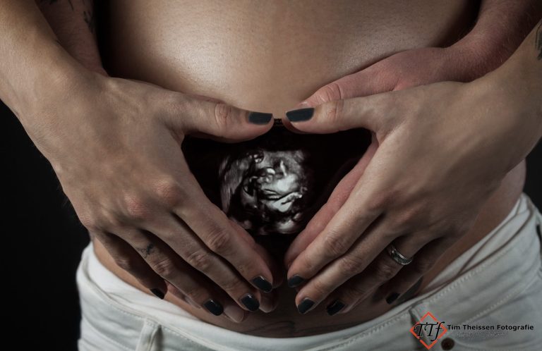 Schwangerschaft und Newborn Schwangere Frau hält Hände zu einem Herz geformt, in der Mitte ist ein Ultraschallbild zu sehen